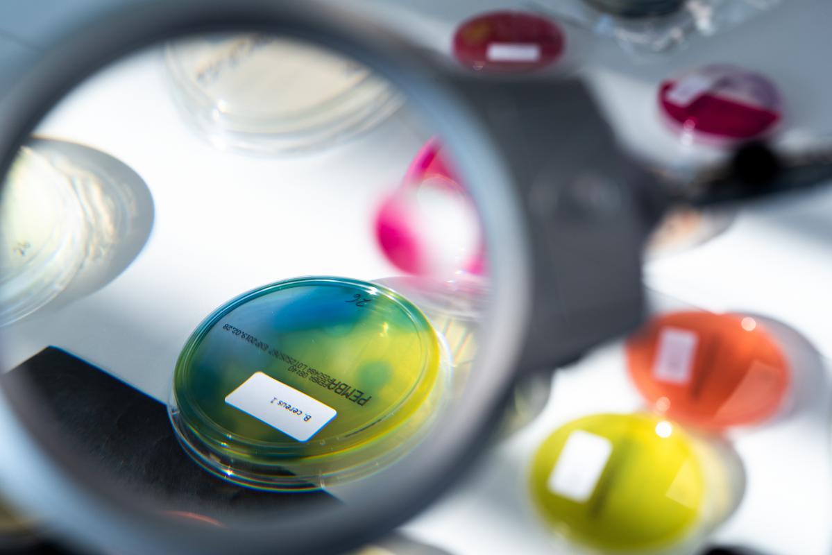 Mikrobiologische Untersuchung | jetzt beauftragen